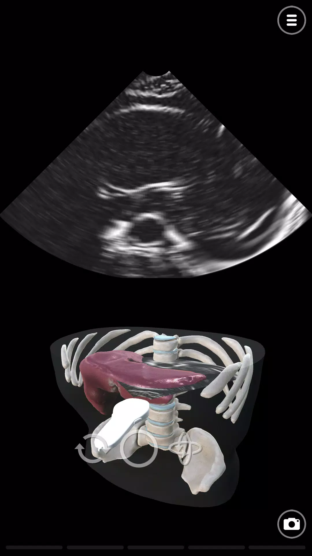Deepscope Ultrasound Simulator ภาพหน้าจอ 1