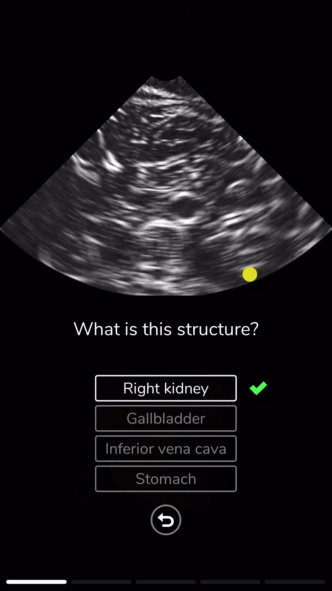 Deepscope Ultrasound Simulator ภาพหน้าจอ 3